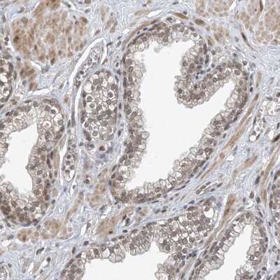 Immunohistochemistry-Paraffin: TAF8 Antibody [NBP2-38188] - Staining of human prostate shows weak to moderate nuclear positivity in glandular cells.