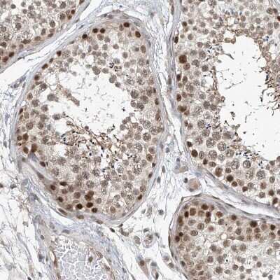 Immunohistochemistry-Paraffin: TAF8 Antibody [NBP2-38188] - Staining of human testis shows moderate to strong nuclear positivity in cells in seminiferous ducts.