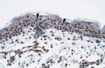 Immunohistochemistry: TAF9 Antibody [NBP2-84289] - Human Skin