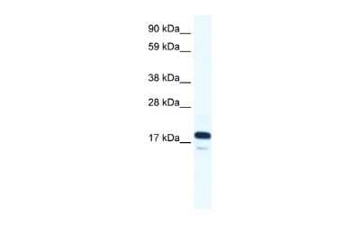 Western Blot: TAF9 Antibody [NBP2-84289] - WB Suggested Anti-TAF9 Antibody Titration: 0.125ug/ml. ELISA Titer: 1:312500. Positive Control: Human Small Intestine