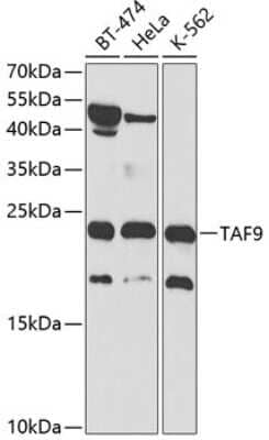 Western Blot: TAF9 Antibody [NBP2-93735] - Analysis of extracts of various cell lines, using TAF9 at 1:1000 dilution. Secondary antibody: HRP Goat Anti-Rabbit IgG (H+L) at 1:10000 dilution. Lysates/proteins: 25ug per lane. Blocking buffer: 3% nonfat dry milk in TBST.