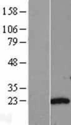 Western Blot: Adenylate Kinase 6 Overexpression Lysate [NBL1-16689] - Left-Empty vector transfected control cell lysate (HEK293 cell lysate); Right -Over-expression Lysate for Adenylate Kinase 6.
