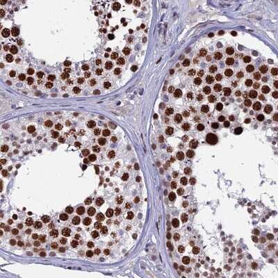 Immunohistochemistry-Paraffin TAF9b Antibody - BSA Free