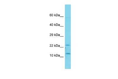 Western Blot: TAFA1/FAM19A1 Antibody [NBP2-88405] - Host: Rabbit. Target Name: FAM19A1. Sample Type: Fetal Kidney lysates. Antibody Dilution: 1.0ug/ml