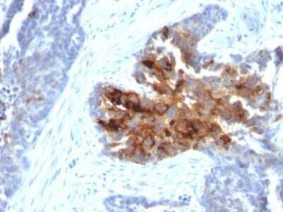 Immunohistochemistry-Paraffin: TAG-72 Antibody (CA72/2869R) [NBP3-07699] - Formalin-fixed, paraffin-embedded human Ovary stained with TAG-72 Rabbit Recombinant Monoclonal Antibody (CA72/2869R).