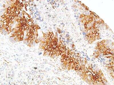 Immunohistochemistry-Paraffin: TAG-72 Antibody (IHC072) [NBP2-75986] - Staining of TAG-72 Antibody (IHC072) in colon.