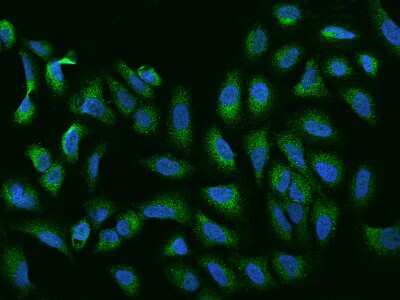 Immunocytochemistry/Immunofluorescence: TAGAP Antibody [NBP2-97756] - Immunofluorescence staining of TAGAP in U2OS cells. Cells were fixed with 4% PFA, permeabilzed with 0.1% Triton X-100 in PBS, blocked with 10% serum, and incubated with rabbit anti-Human TAGAP polyclonal antibody (dilution ratio 1:100) at 4C overnight. Then cells were stained with the Alexa Fluor(R)488-conjugated Goat Anti-rabbit IgG secondary antibody (green) and counterstained with DAPI (blue).Positive staining was localized to Cytoplasm.