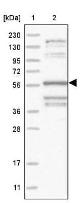 Western Blot TAGAP Antibody