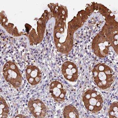 Immunohistochemistry TAK1L Antibody - BSA Free