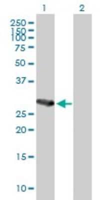 Western Blot TAK1L Antibody - Azide and BSA Free