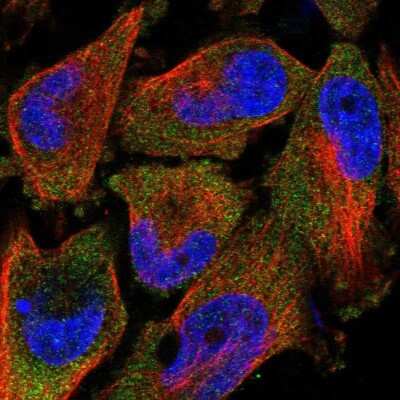 Immunocytochemistry/ Immunofluorescence TAL2 Antibody