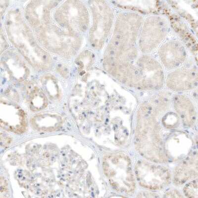 Immunohistochemistry-Paraffin TAL2 Antibody