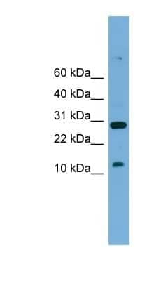 Western Blot: TAL2 Antibody [NBP1-80224] - Mouse Small Intestine, concentration 0.2-1 ug/ml.