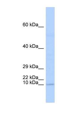 Western Blot: TAL2 Antibody [NBP1-80307] - Human Brain lysate, concentration 0.2-1 ug/ml.