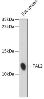 Western Blot: TAL2 Antibody [NBP2-93861] - Analysis of extracts of rat spleen, using TAL2 .Exposure time: 10s.