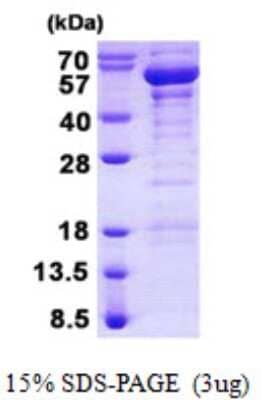 SDS-PAGE Recombinant Human TANK His Protein