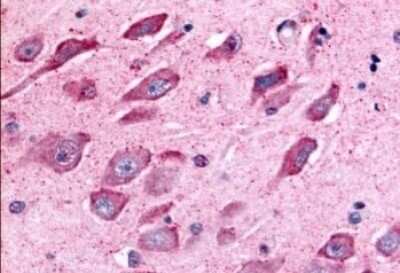 Immunohistochemistry-Paraffin: TAO Kinase 1 Antibody [NLS6871] - Anti-TAOK1 antibody IHC of human brain, hippocampus. Immunohistochemistry of formalin-fixed, paraffin-embedded tissue after heat-induced antigen retrieval.
