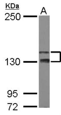 Western Blot: TAO2 Antibody [NBP2-20562] - Sample (50 ug of whole cell lysate)  A: Mouse Brain, 5% SDS PAGE gel, diluted at 1:1000.