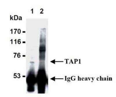Immunoprecipitation: TAP1 Antibody (TAP1.28) [NBP1-54435] - Immunoprecipitation of TAP1 from LCL721 celss with (1) NBP1-54435 or (2) mouse IgG.  After immunoprecipitated with the antibody, immunocomplex was resolved on SDS-PAGE and immunoblotted with NBP1-54435.