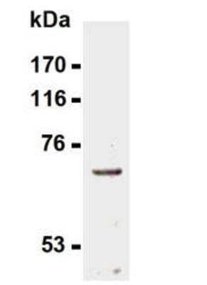 Western Blot: TAP1 Antibody (TAP1.28) [NBP1-54435] - Western Blot analysis of TAP1 expression using NBP1-54435 in LCL721 cells