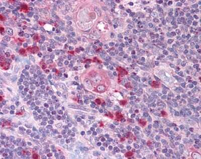 Immunohistochemistry-Paraffin: TAP2 Antibody [NBP1-40335] - Analysis of anti-TAP2 antibody with human thymus at concentration 10 ug/ml.