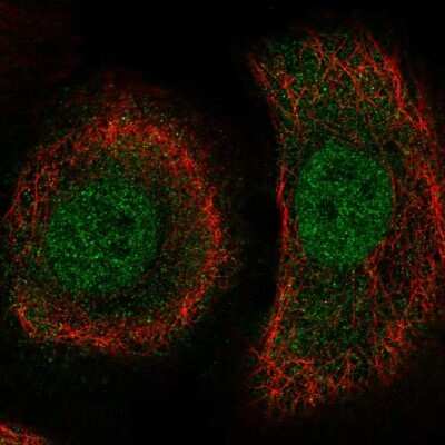 Immunocytochemistry/Immunofluorescence: TAPP1/PLEKHA1 Antibody [NBP2-57495] - Staining of human cell line HaCaT shows localization to nucleoplasm & cytosol.