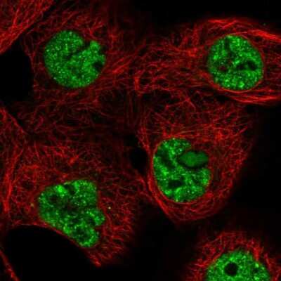 Immunocytochemistry/ Immunofluorescence TARBP1 Antibody - BSA Free