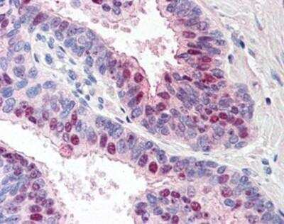 Immunohistochemistry-Paraffin: TARBP1 Antibody [NBP1-03040] - Staining of human prostate. Immunohistochemistry of formalin-fixed, paraffin-embedded tissue after heat-induced antigen retrieval. Antibody concentration 5 ug/ml.