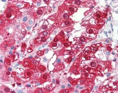 Immunohistochemistry-Paraffin: TARBP1 Antibody [NBP1-03040] - Staining of human adrenal. Immunohistochemistry of formalin-fixed, paraffin-embedded tissue after heat-induced antigen retrieval. Antibody concentration 5 ug/ml.