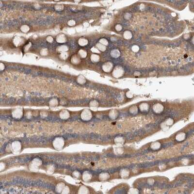 Immunohistochemistry-Paraffin: TARBP1 Antibody [NBP1-86902] - Staining of human duodenum shows cytoplasmic positivity in glandular cells.