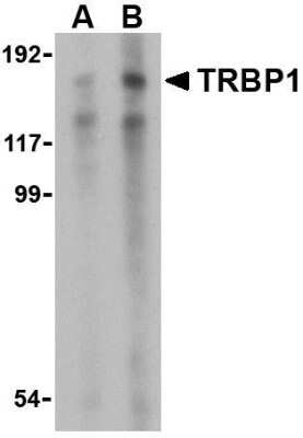 Western Blot TARBP1 Antibody - BSA Free
