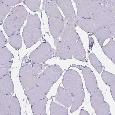 Immunohistochemistry-Paraffin: TARSH Antibody [NBP2-48811] - Staining of human skeletal muscle shows no positivity in myocytes as expected.