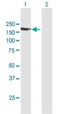 Western Blot: TARSH Antibody [H00025890-B01P] - Analysis of ABI3BP expression in transfected 293T cell line by ABI3BP polyclonal antibody.  Lane 1: ABI3BP transfected lysate(118.25 KDa). Lane 2: Non-transfected lysate.