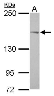 Western Blot: TARSH Antibody [NBP2-20569] - Sample (30 ug of whole cell lysate) A: HeLa 5% SDS PAGE gel, diluted at 1:1000.
