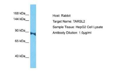 Western Blot: TARSL2 Antibody [NBP2-83616] - Host: Rabbit. Target Name: TARSL2. Sample Type: HepG2 Whole Cell lysates. Antibody Dilution: 1.0ug/ml