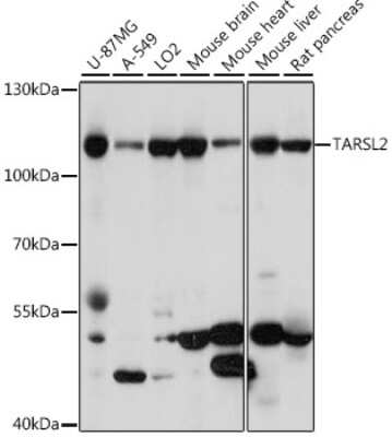 Western Blot: TARSL2 Antibody [NBP2-94438] - Analysis of extracts of various cell lines, using TARSL2 at 1:1000 dilution. Secondary antibody: HRP Goat Anti-Rabbit IgG (H+L) at 1:10000 dilution. Lysates/proteins: 25ug per lane. Blocking buffer: 3% nonfat dry milk in TBST. Detection: ECL Basic Kit . Exposure time: 30s.