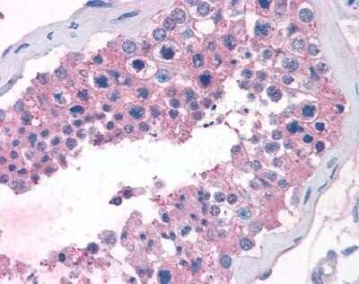 Immunohistochemistry-Paraffin: TAS1R1 Antibody [NLS1992] - Analysis of anti-T1R1 / TAS1R1 antibody with human testis.