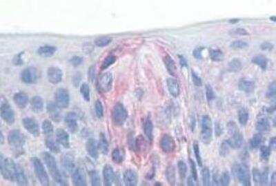 Immunohistochemistry-Paraffin: TAS1R1 Antibody [NLS1992] - Tongue, taste receptor