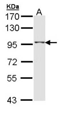 Western Blot: TAS1R1 Antibody [NBP2-20570] - Sample (30 ug of whole cell lysate) A: H1299 7. 5% SDS PAGE gel, diluted at 1:1000.