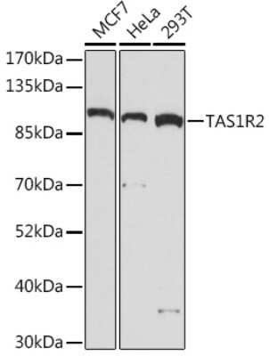 Western Blot: TAS1R2 Antibody [NBP3-15535] - Western blot analysis of extracts of various cell lines, using TAS1R2 Rabbit pAb (NBP3-15535) at 1:1000 dilution. Secondary antibody: HRP Goat Anti-Rabbit IgG (H+L) at 1:10000 dilution. Lysates/proteins: 25ug per lane. Blocking buffer: 3% nonfat dry milk in TBST. Detection: ECL Basic Kit. Exposure time: 5min.