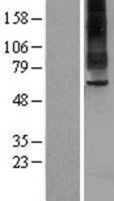 Western Blot: TAS1R2 Overexpression Lysate (Adult Normal) [NBL1-16706] Left-Empty vector transfected control cell lysate (HEK293 cell lysate); Right -Over-expression Lysate for TAS1R2.