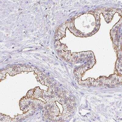 Immunohistochemistry-Paraffin: TAS1R3 Antibody [NBP2-33683] - Staining of human prostate shows moderate membranous positivity in glandular cells.