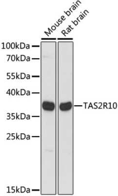 Western Blot TAS2R10 Antibody - Azide and BSA Free