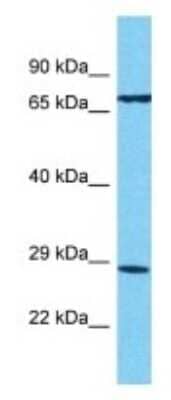 Western Blot TAS2R13 Antibody