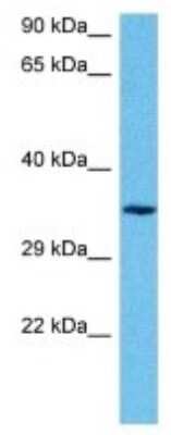 Western Blot TAS2R14 Antibody