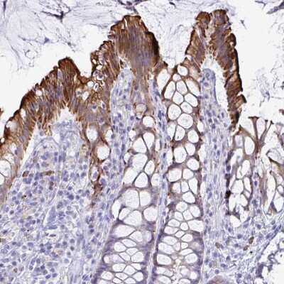 Immunohistochemistry-Paraffin: TAS2R38 Antibody [NBP2-33711] - Staining of human rectum shows strong cytoplasmic and membranous positivity in glandular cells.