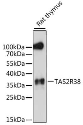 Western Blot: TAS2R38 Antibody [NBP2-95168] - Analysis of extracts of rat thymus, using TAS2R38 .Exposure time: 90s.