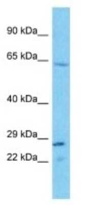 Western Blot: TAS2R43 Antibody [NBP3-09666] - Western blot analysis of TAS2R43 in HepG2 Whole Cell lysates. Antibody dilution at 1.0ug/ml