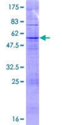 Western Blot: TAS2R43 Recombinant Protein [h00259289-P01]