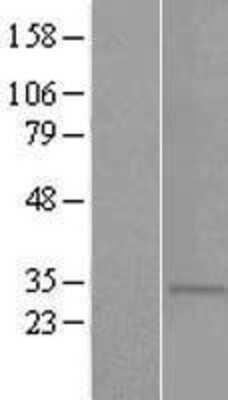 Western Blot: TAS2R5 Overexpression Lysate (Adult Normal) [NBP2-06740] Left-Empty vector transfected control cell lysate (HEK293 cell lysate); Right -Over-expression Lysate for TAS2R5.